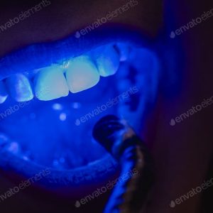 Dental lights